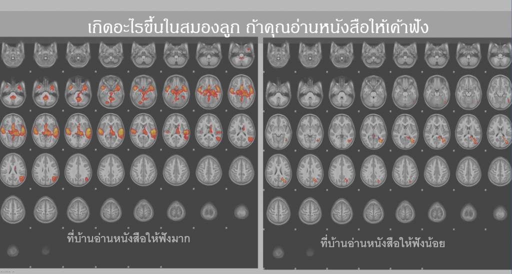 การอ่านกับสมอง ตอนที่ 1 : หมอแพมชวนอ่าน